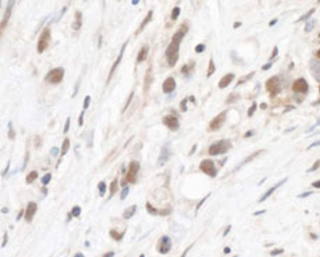 Detection of human RPL5 by immunohistochemistry.