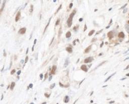 Detection of human RPL5 by immunohistochemistry.