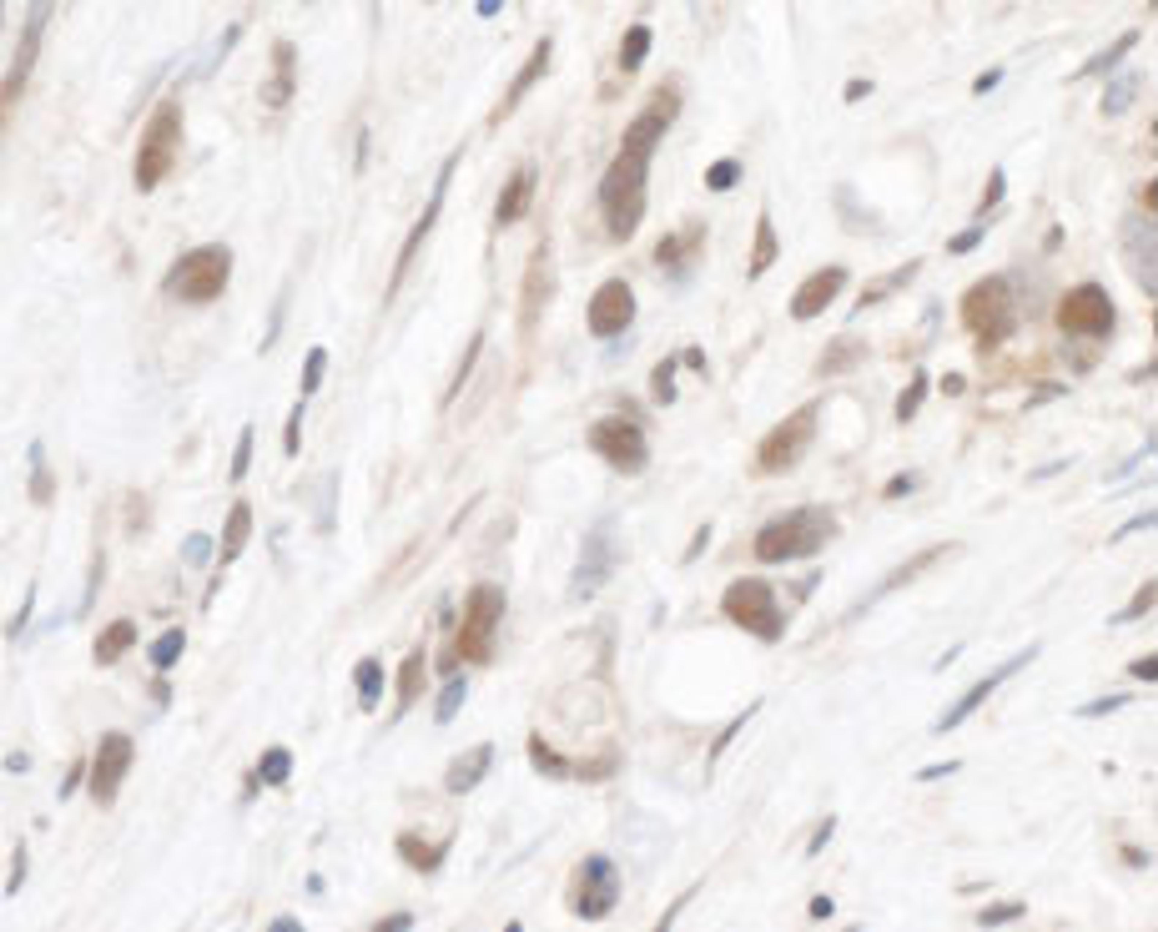 Detection of human RPL5 by immunohistochemistry.