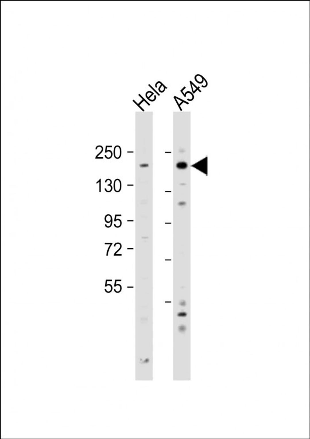 Western Blot at 1:2000 dilution Lane 1: Hela whole cell lysate Lane 2: A549 whole cell lysate Lysates/proteins at 20 ug per lane.