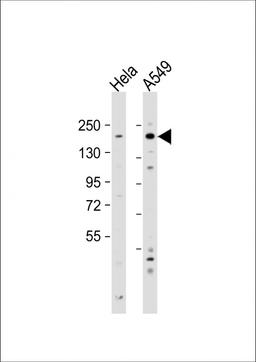 Western Blot at 1:2000 dilution Lane 1: Hela whole cell lysate Lane 2: A549 whole cell lysate Lysates/proteins at 20 ug per lane.