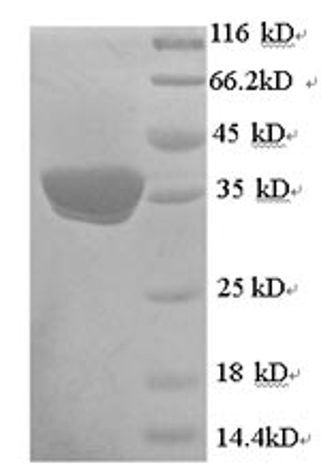 (Tris-Glycine gel) Discontinuous SDS-PAGE (reduced) with 5% enrichment gel and 15% separation gel.