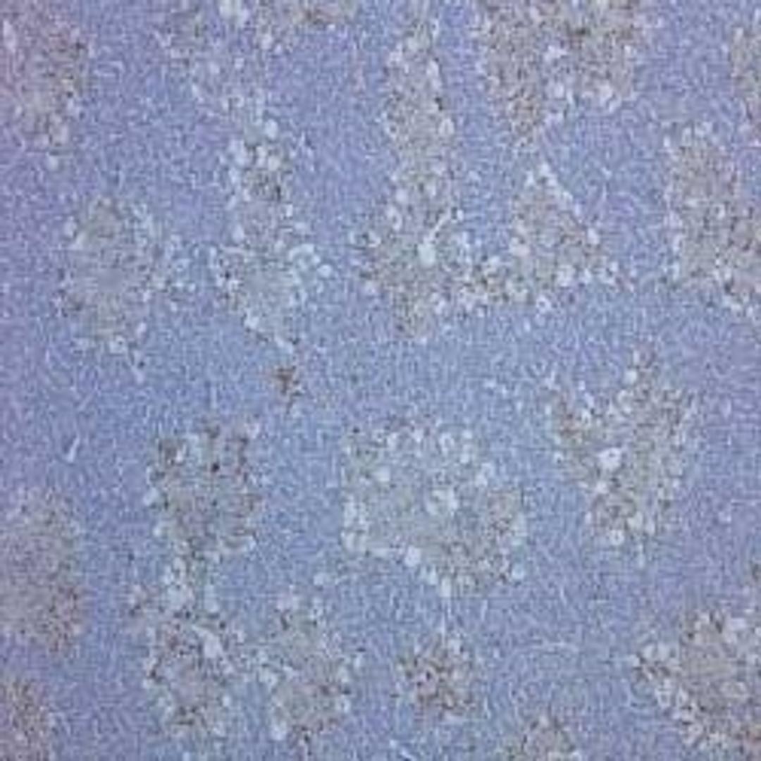 Staining of rat liver, with induced hepatocellular damage, with Mouse anti Rat CD68, clone ED1