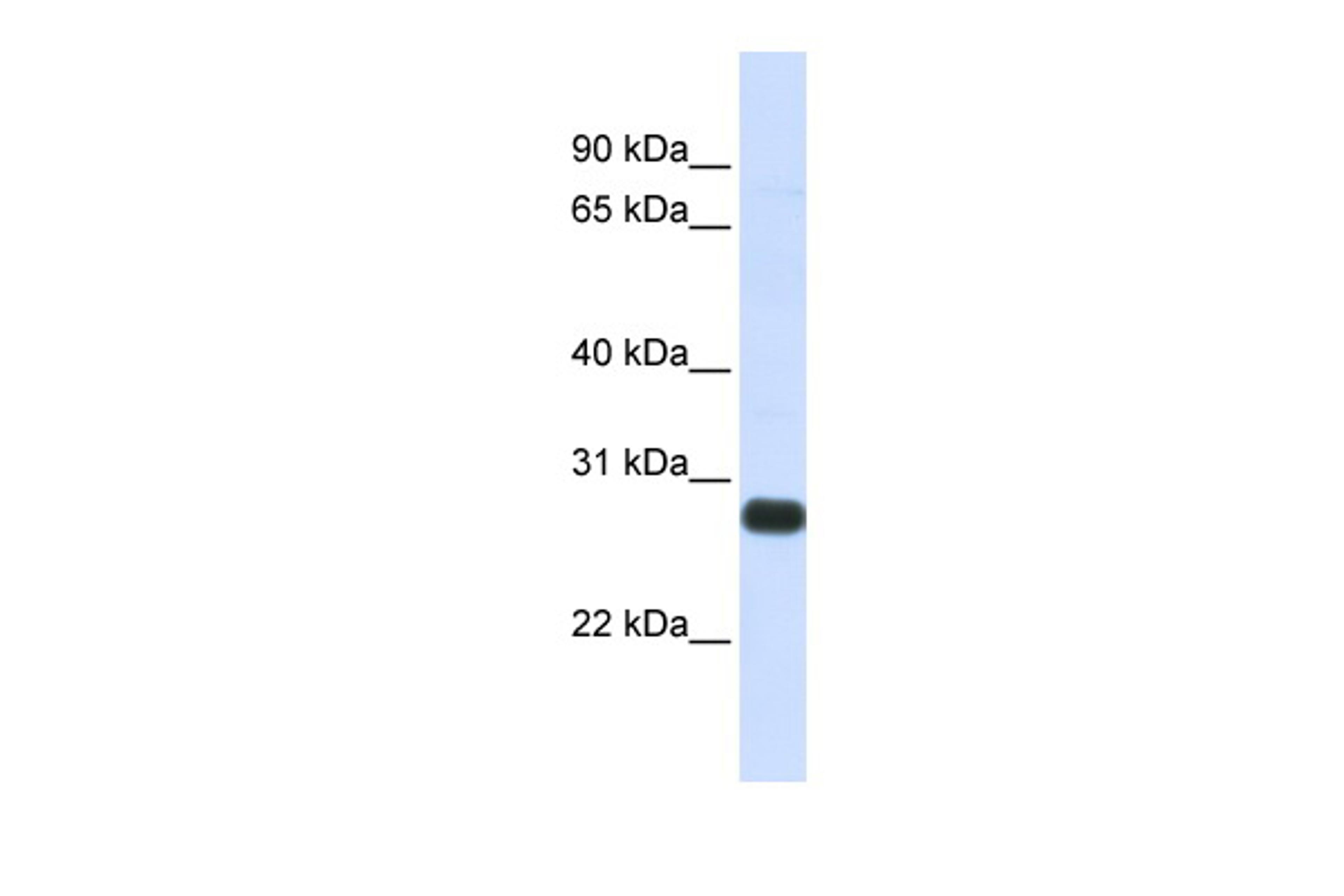 Antibody used in WB on Human Heart at 0.2-1 ug/ml.