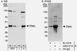 Detection of human Pfetin by western blot and immunoprecipitation.