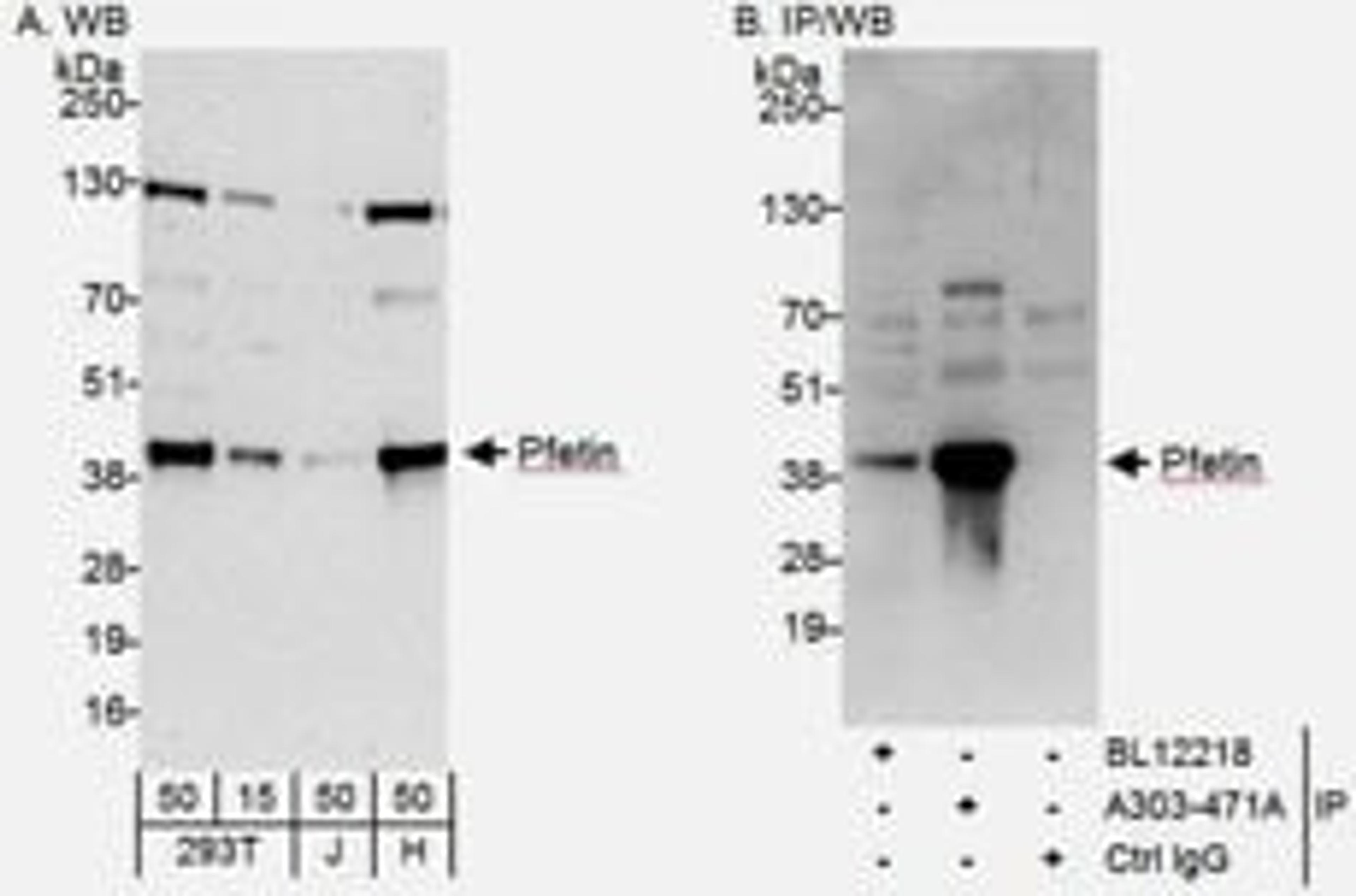 Detection of human Pfetin by western blot and immunoprecipitation.