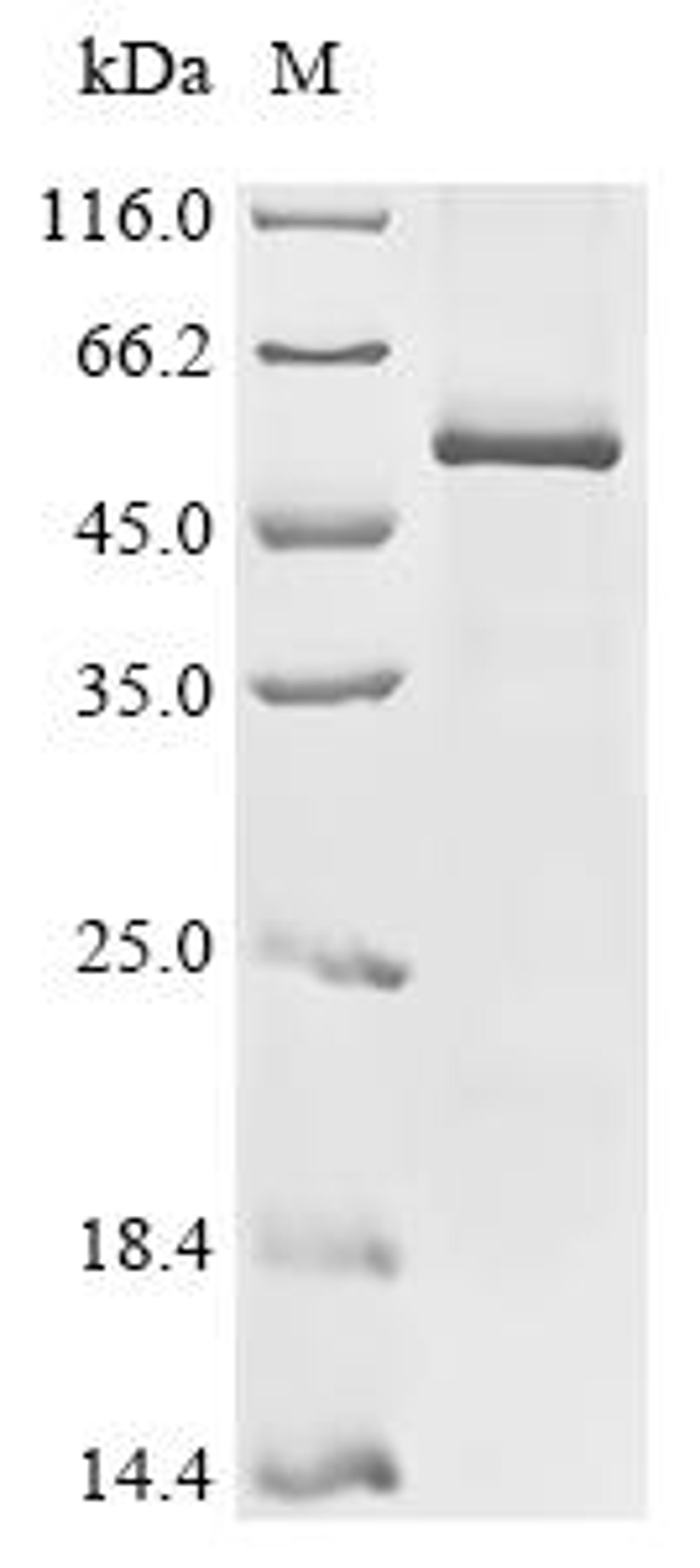 (Tris-Glycine gel) Discontinuous SDS-PAGE (reduced) with 5% enrichment gel and 15% separation gel.