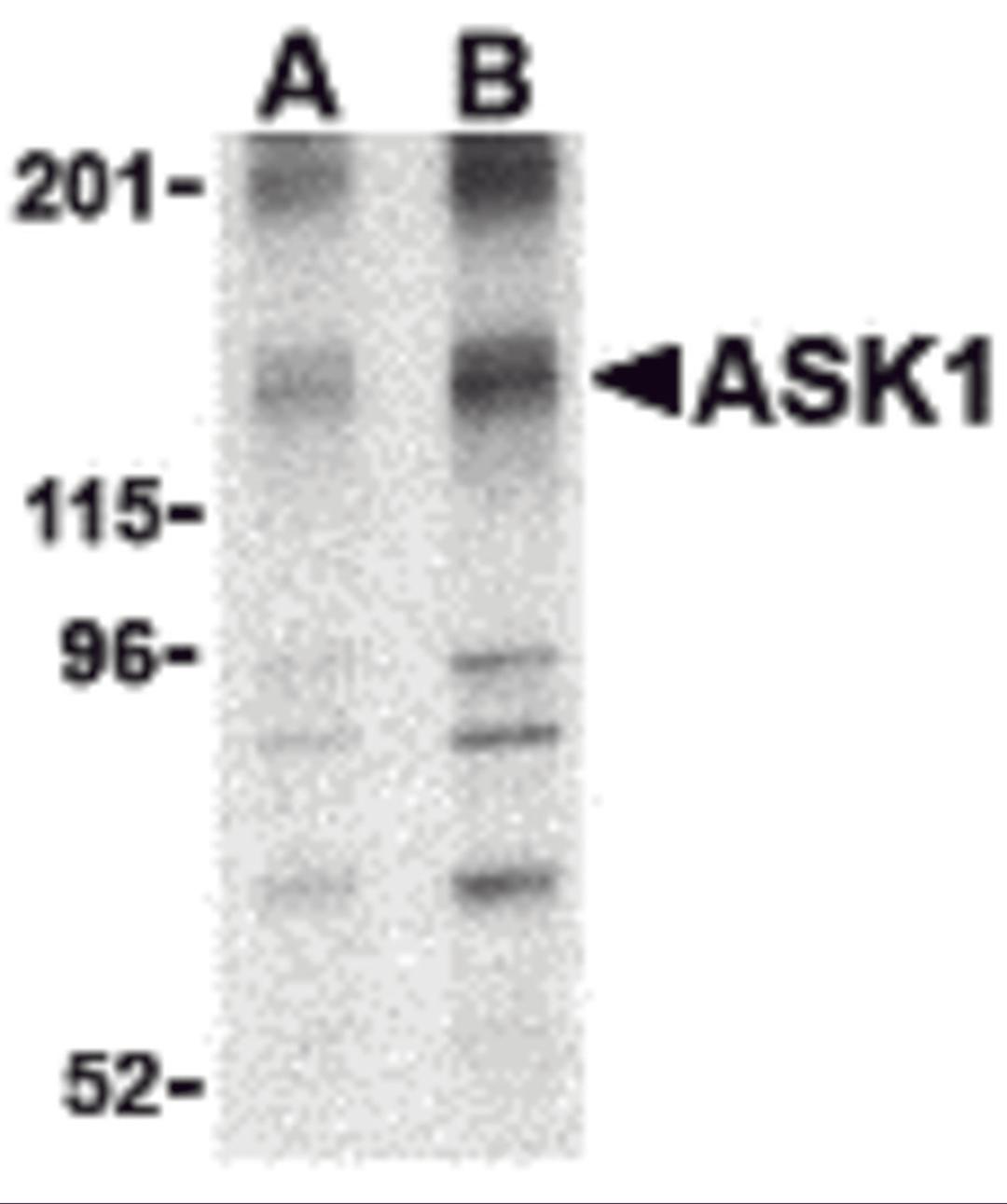 Western blot analysis of ASK1 in 3T3 cell lysate with ASK1 antibody at (A) 1 and (B) 2 &#956;g/mL.