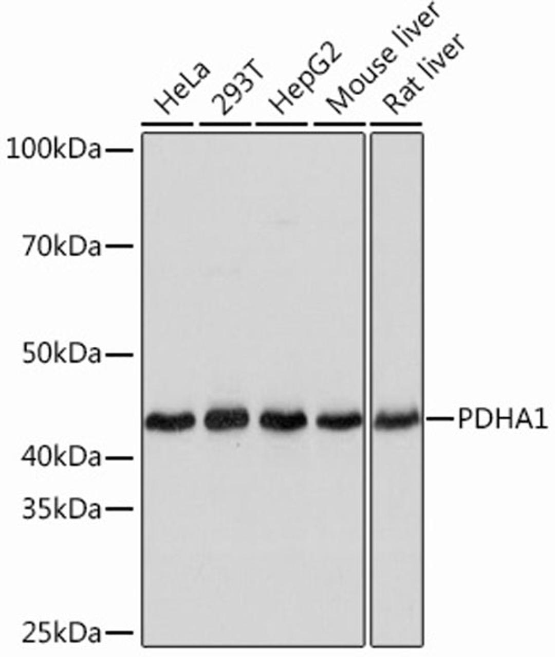 Western blot - PDHA1 Rabbit mAb (A13687)