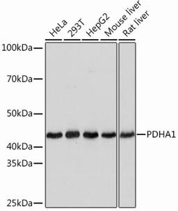 Western blot - PDHA1 Rabbit mAb (A13687)