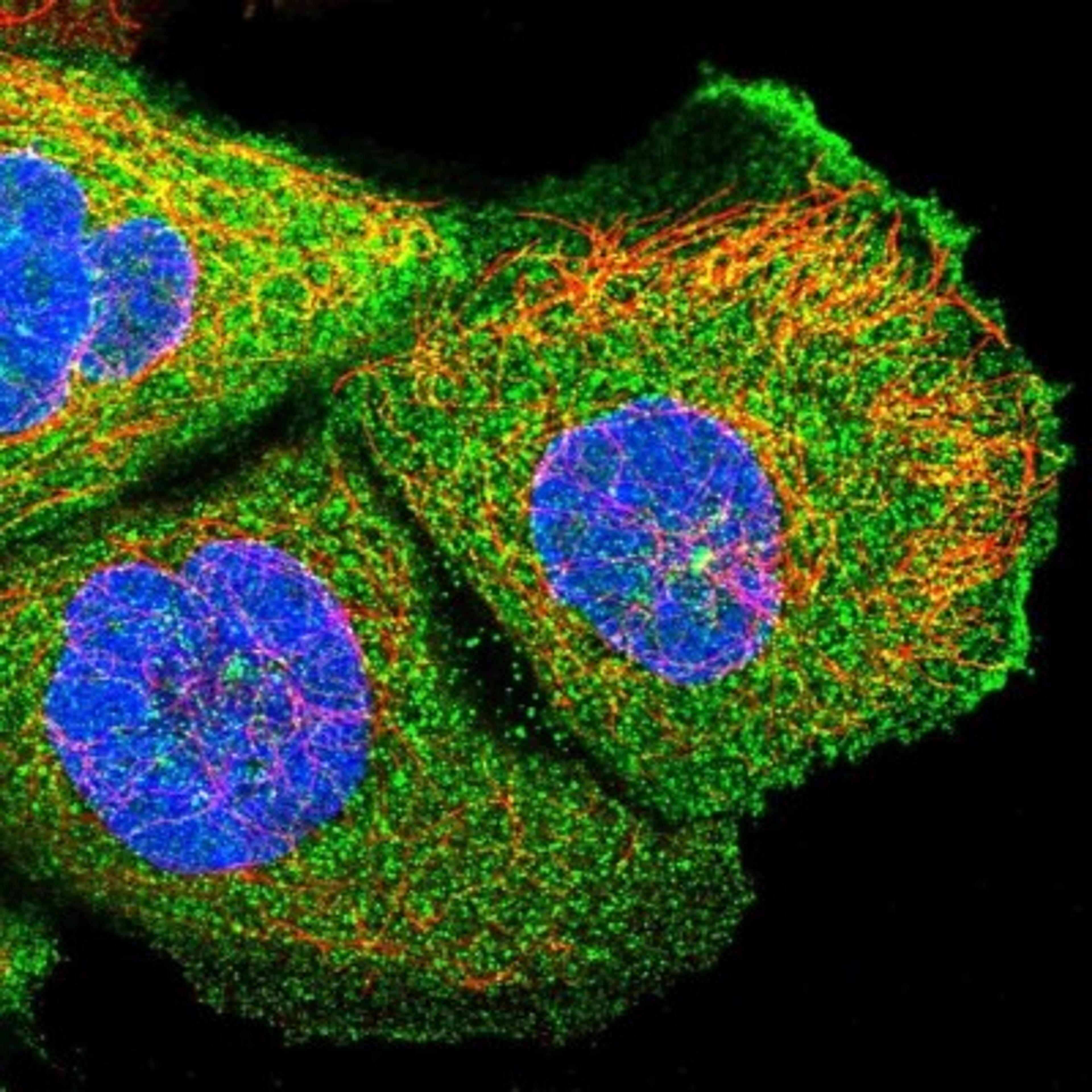 Immunofluorescence: MPHOSPH9- Antibody [NBP1-87870] - Staining of human cell line A-431 shows positivity in plasma membrane, cytoplasm & centrosome.