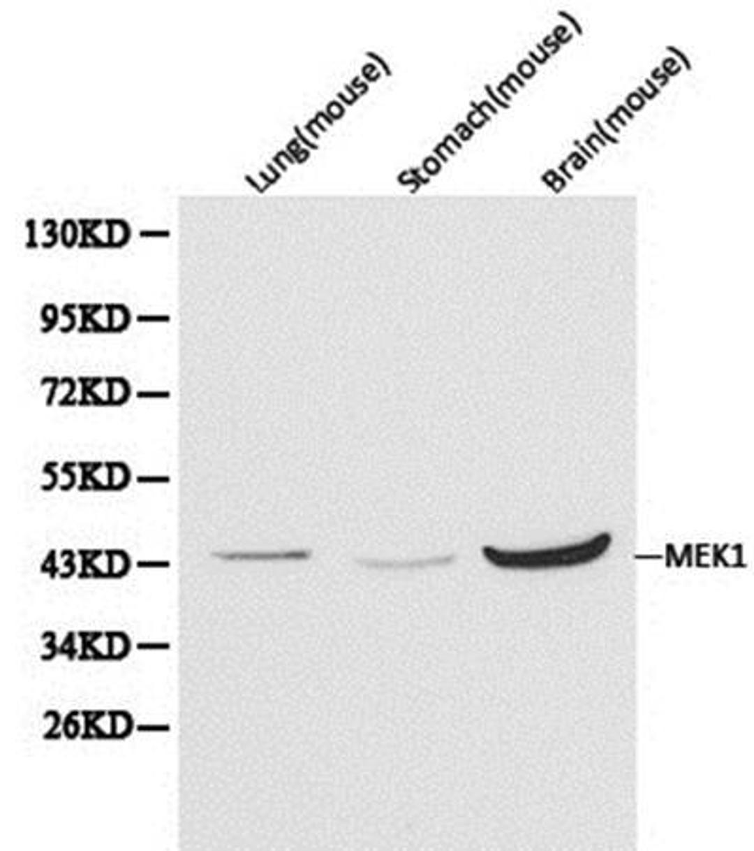 Western blot analysis of extracts of various cell line lysates using MEK1 antibody