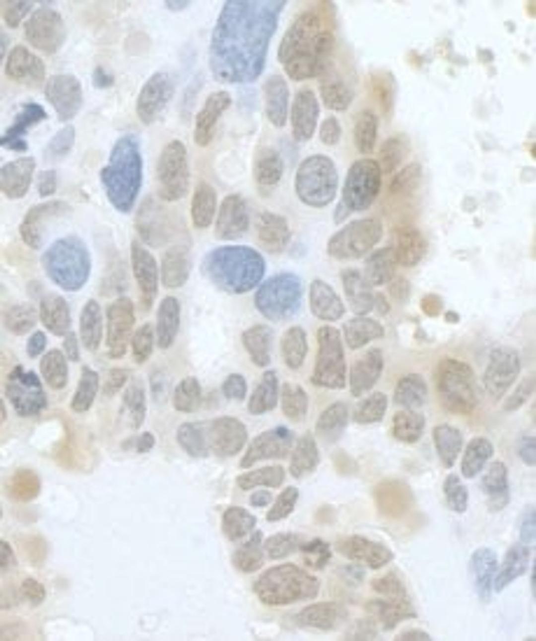 Detection of human HURP/DLG7 by immunohistochemistry.