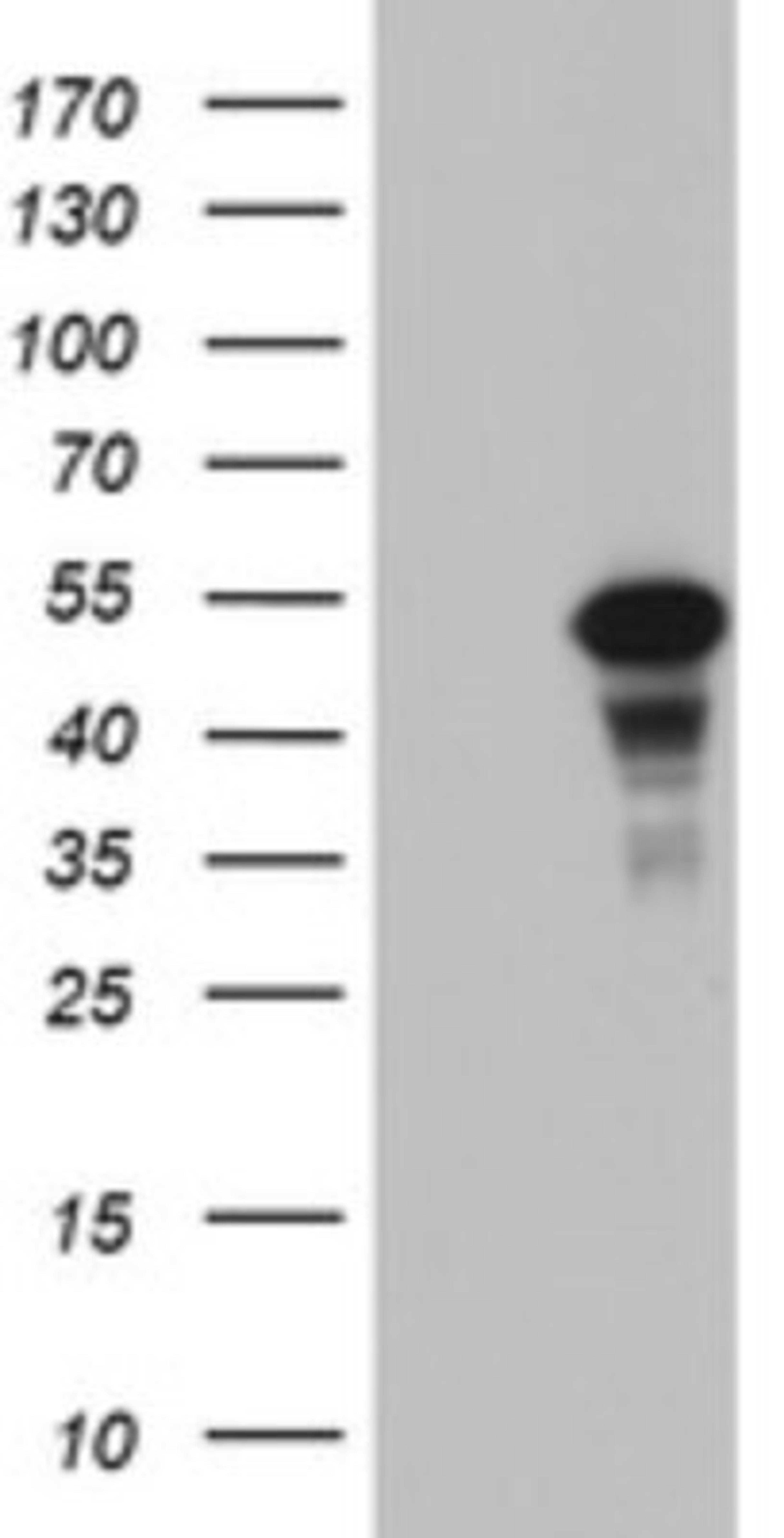 Western Blot: CDCA7L Antibody (3B5) [NBP2-46198] - Analysis of HEK293T cells were transfected with the pCMV6-ENTRY control (Left lane) or pCMV6-ENTRY CDCA7L.