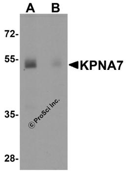Western blot analysis of KPNA7 in human spleen with KPNA7 antibody at 1 μg/ml in (A) the absence and (B) the presence of blocking peptide.