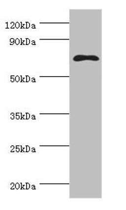 Western blot. All lanes: MSLN antibody at 8µg/ml + Hela whole cell lysate. Secondary. Goat polyclonal to rabbit IgG at 1/10000 dilution. Predicted band size: 69, 72, 68 kDa. Observed band size: 69 kDa