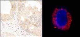 Detection of human cAbl by immunohistochemistry and immunocytochemistry.