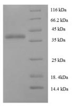 (Tris-Glycine gel) Discontinuous SDS-PAGE (reduced) with 5% enrichment gel and 15% separation gel.