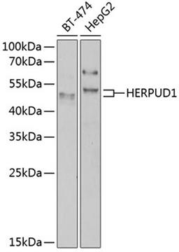 Western blot - HERPUD1 antibody (A7048)