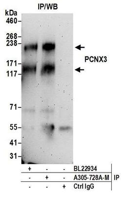 Detection of human PCNX3 by WB of IP.