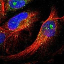 Immunocytochemistry/Immunofluorescence: GCNT3 Antibody [NBP1-88313] - Staining of human cell line U-251MG shows positivity in nucleoli & cytoplasm.