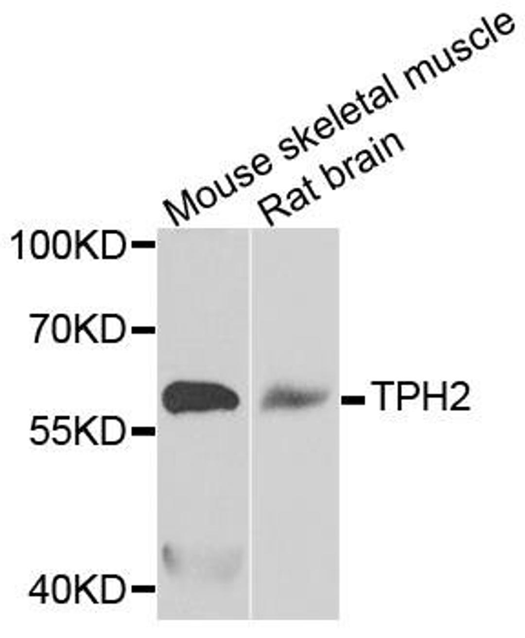 Western blot analysis of extracts of various tissues using TPH2 antibody