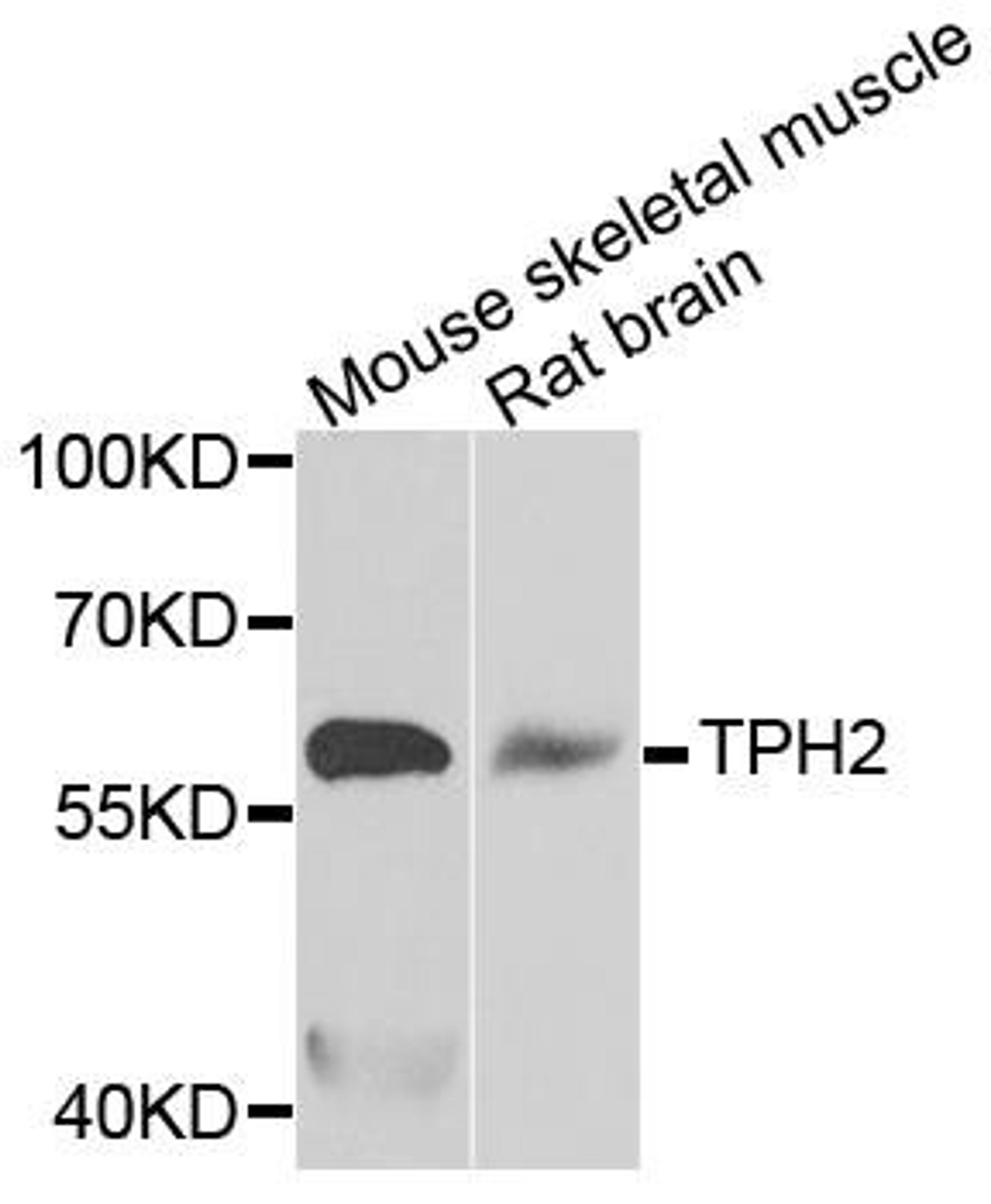 Western blot analysis of extracts of various tissues using TPH2 antibody