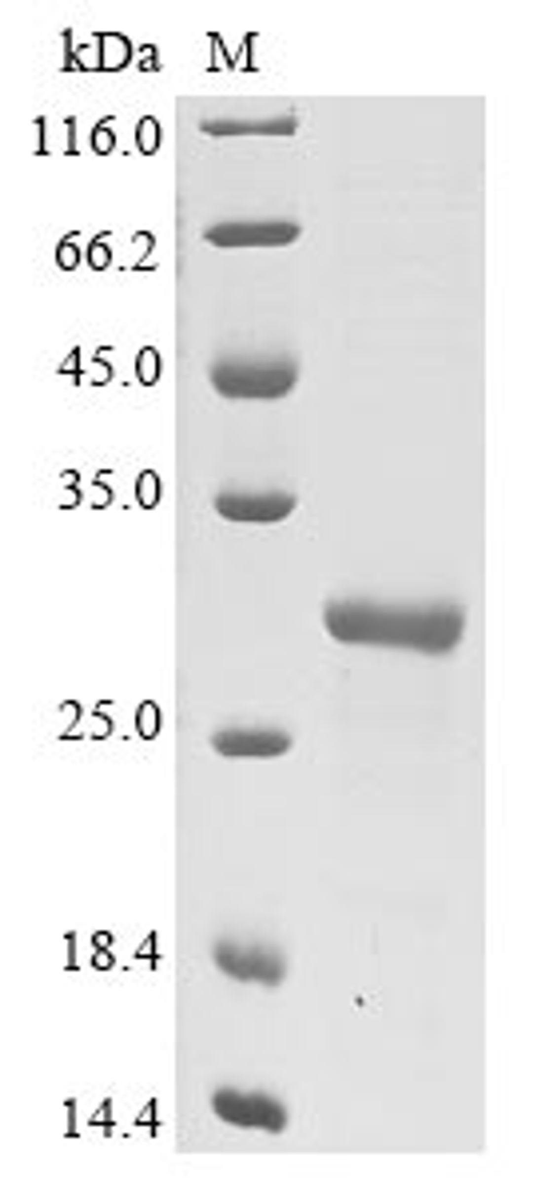 (Tris-Glycine gel) Discontinuous SDS-PAGE (reduced) with 5% enrichment gel and 15% separation gel.