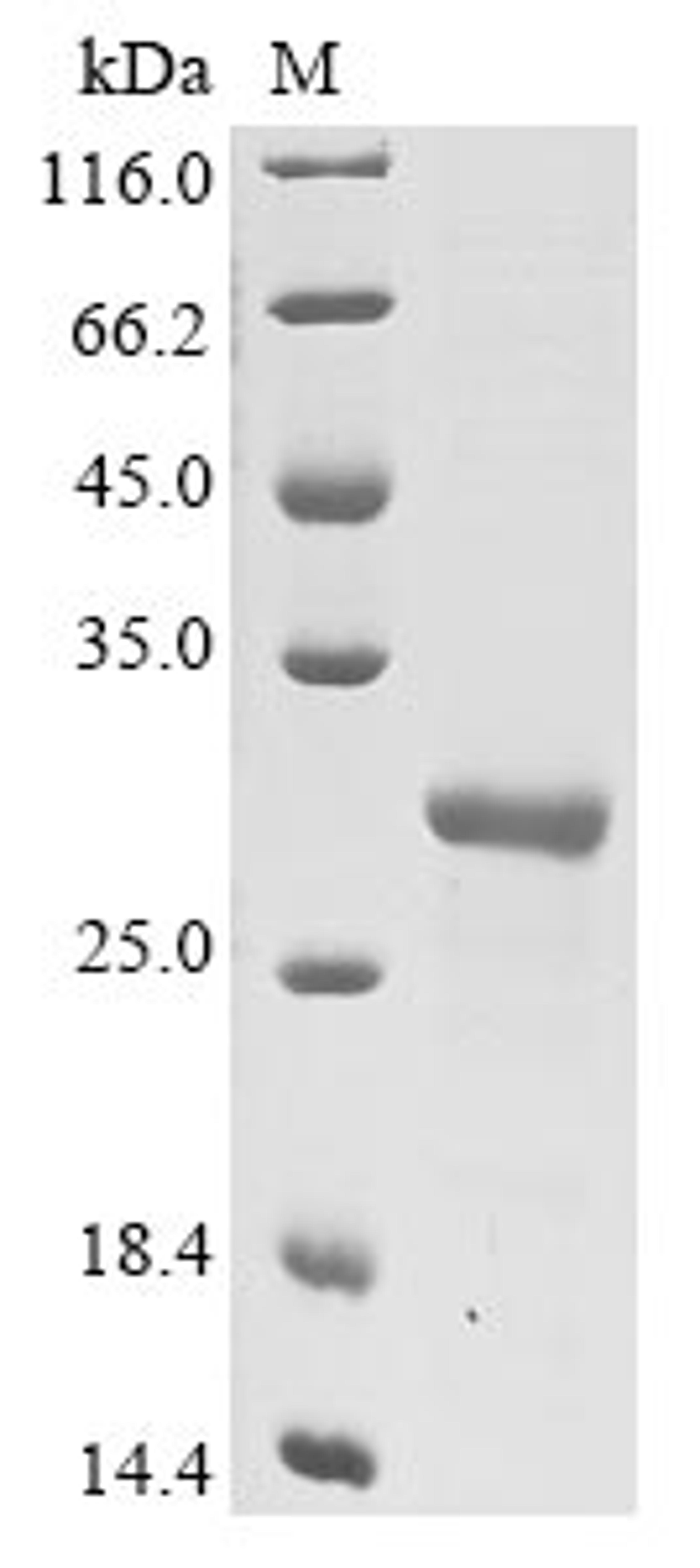 (Tris-Glycine gel) Discontinuous SDS-PAGE (reduced) with 5% enrichment gel and 15% separation gel.