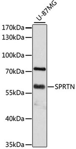 Western blot - SPRTN antibody (A11620)