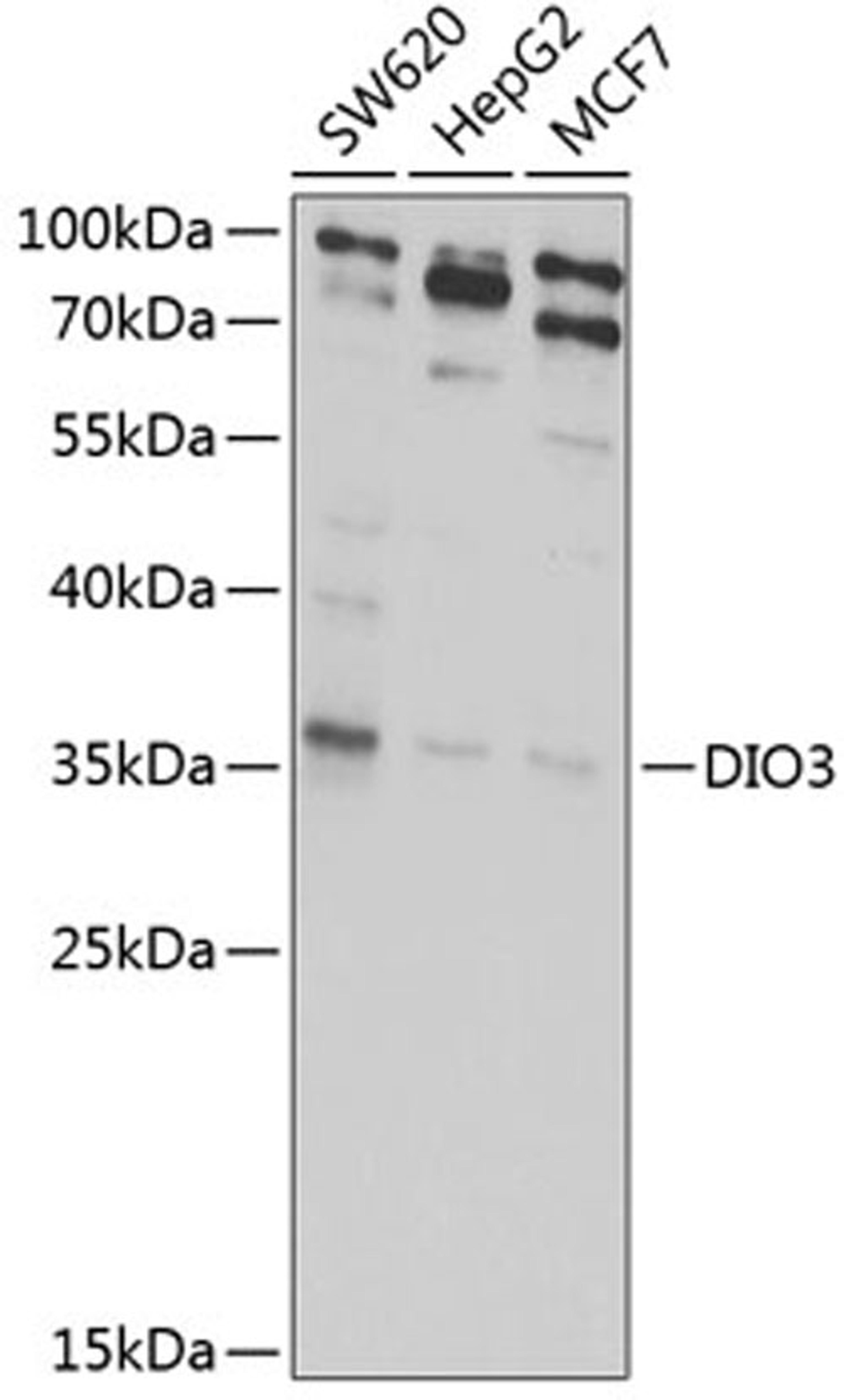 Western blot - DIO3 antibody (A6900)