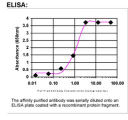 ELISA: CD96 Antibody [25920002]