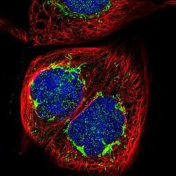 Immunocytochemistry/Immunofluorescence: DARS2 Antibody [NBP1-83854] - Staining of human cell line A-431 shows positivity in nucleus but not nucleoli & mitochondria.