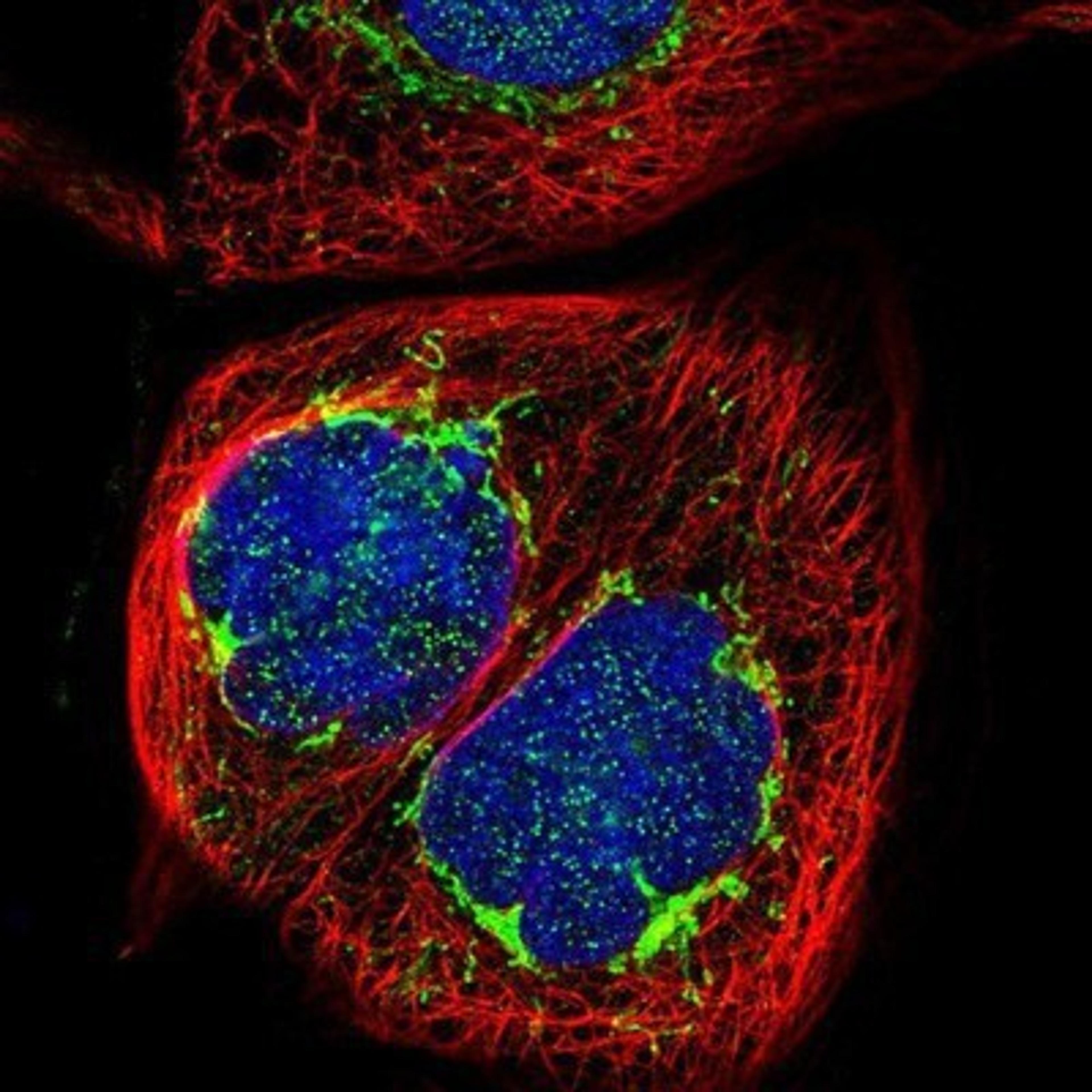 Immunocytochemistry/Immunofluorescence: DARS2 Antibody [NBP1-83854] - Staining of human cell line A-431 shows positivity in nucleus but not nucleoli & mitochondria.