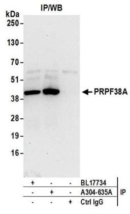 Detection of human PRPF38A by western blot of immunoprecipitates.