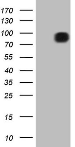 Western Blot: FSIP1 Antibody (4F9) [NBP2-45738] - Analysis of HEK293T cells were transfected with the pCMV6-ENTRY control (Left lane) or pCMV6-ENTRY FSIP1.