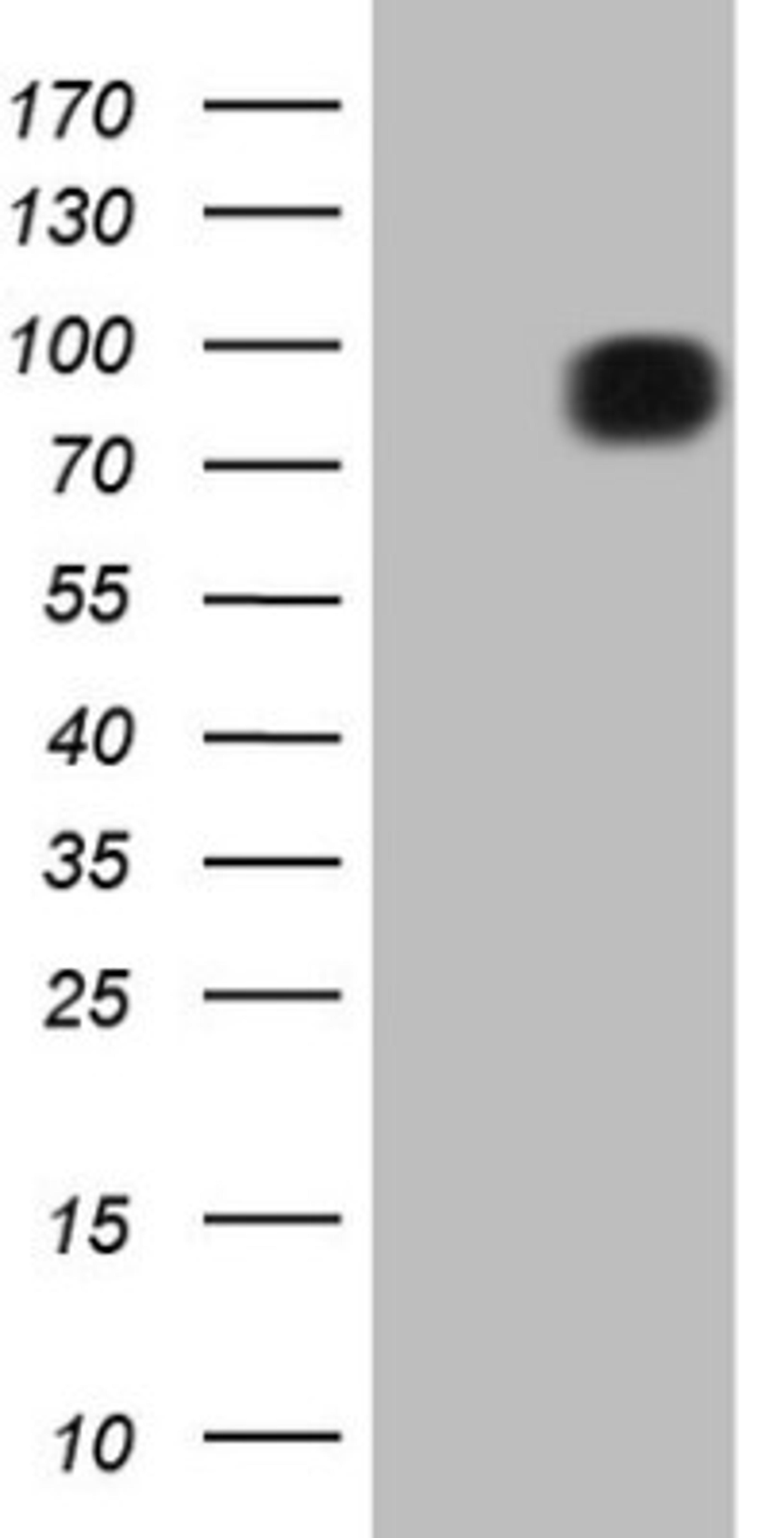 Western Blot: FSIP1 Antibody (4F9) [NBP2-45738] - Analysis of HEK293T cells were transfected with the pCMV6-ENTRY control (Left lane) or pCMV6-ENTRY FSIP1.