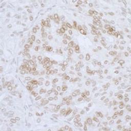 Detection of human LAP2 beta/TMPO by immunohistochemistry.