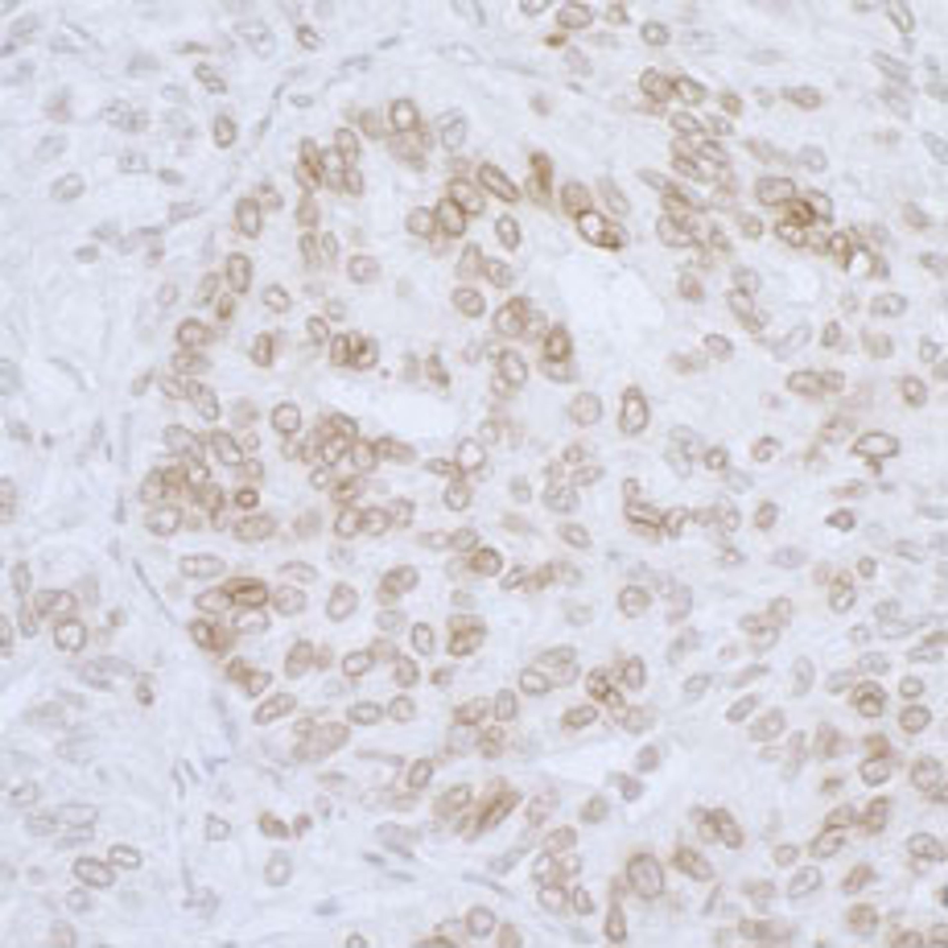 Detection of human LAP2 beta/TMPO by immunohistochemistry.