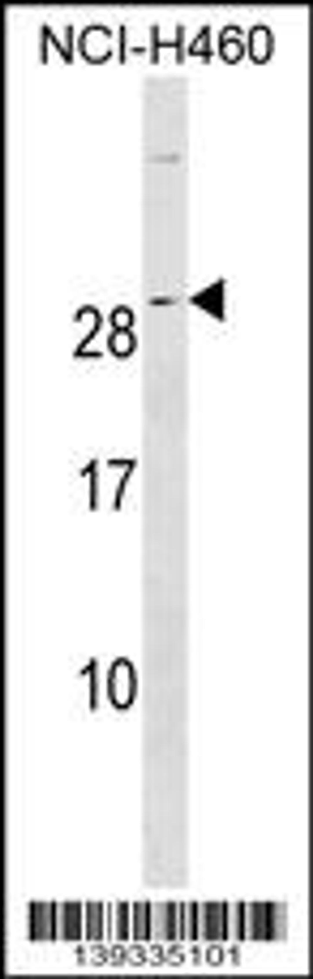 Western blot analysis in NCI-H460 cell line lysates (35ug/lane).