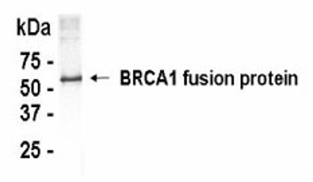 Western Blot: XW-7058 at a 1:2,000 dilution. E.coli derived human BRCA1 fusion protein as test antigen.