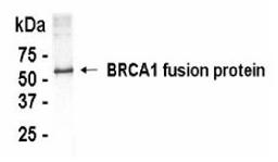 Western Blot: XW-7058 at a 1:2,000 dilution. E.coli derived human BRCA1 fusion protein as test antigen.