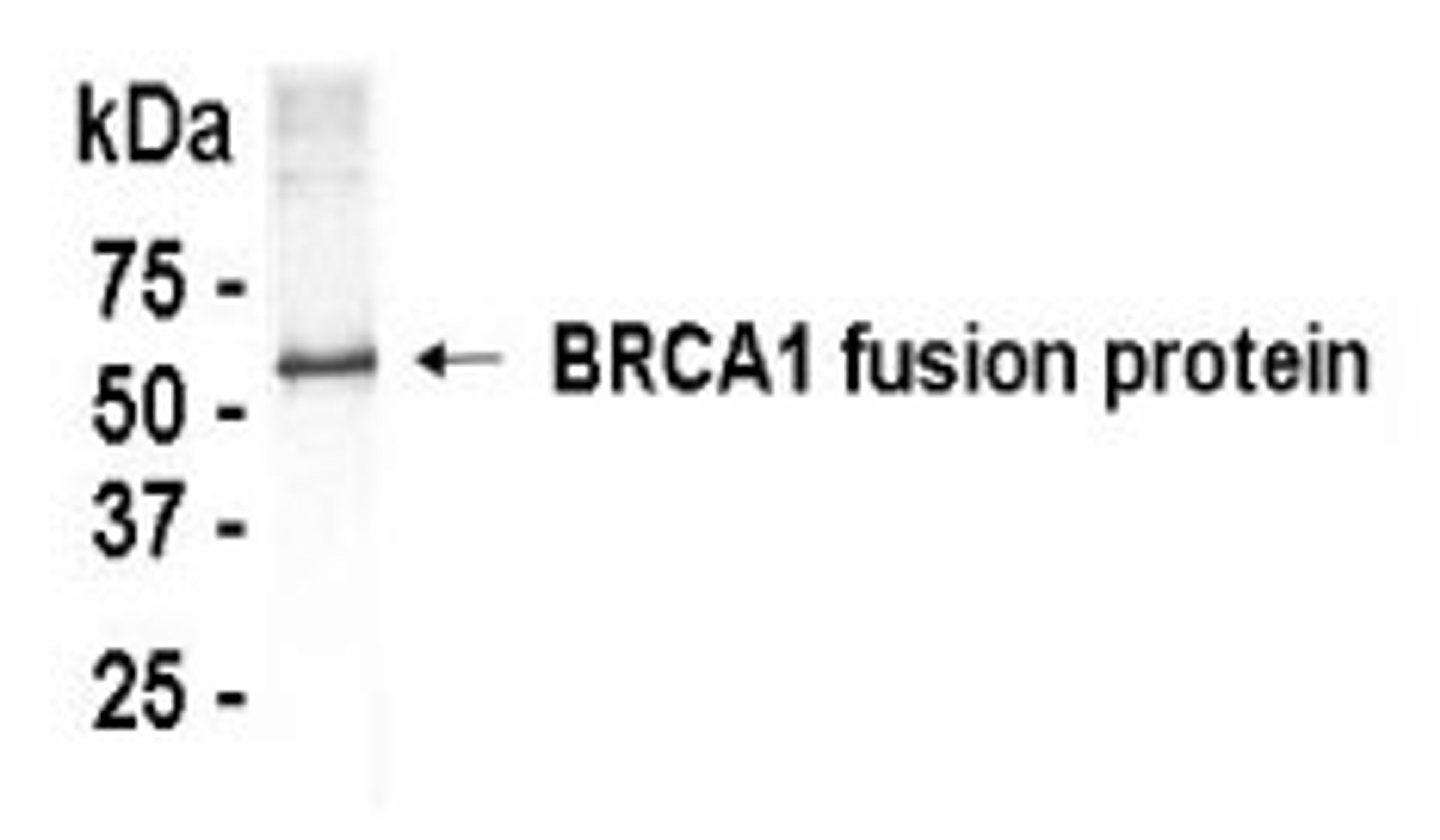 Western Blot: XW-7058 at a 1:2,000 dilution. E.coli derived human BRCA1 fusion protein as test antigen.