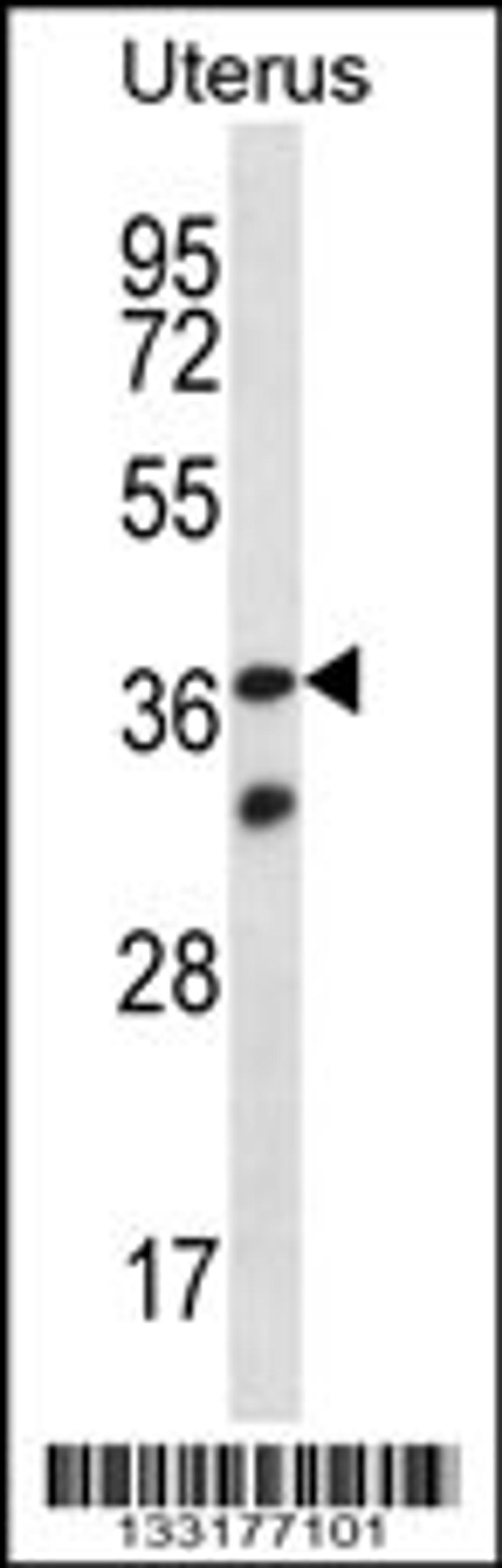 Western blot analysis in human normal Uterus tissue lysates (35ug/lane).