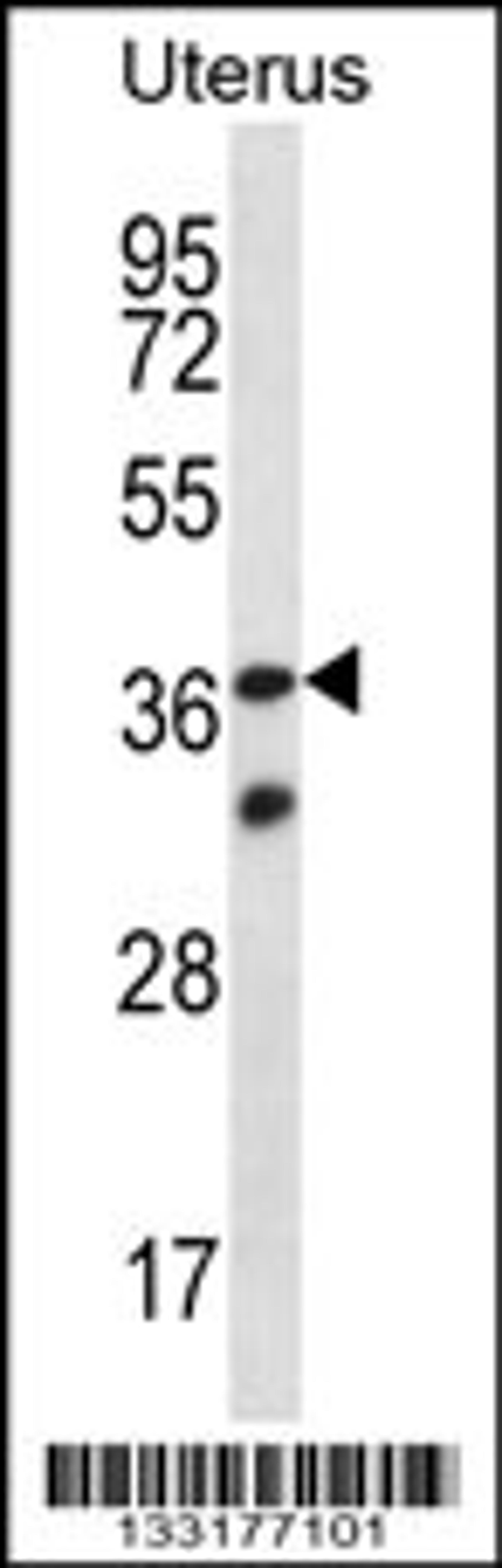 Western blot analysis in human normal Uterus tissue lysates (35ug/lane).