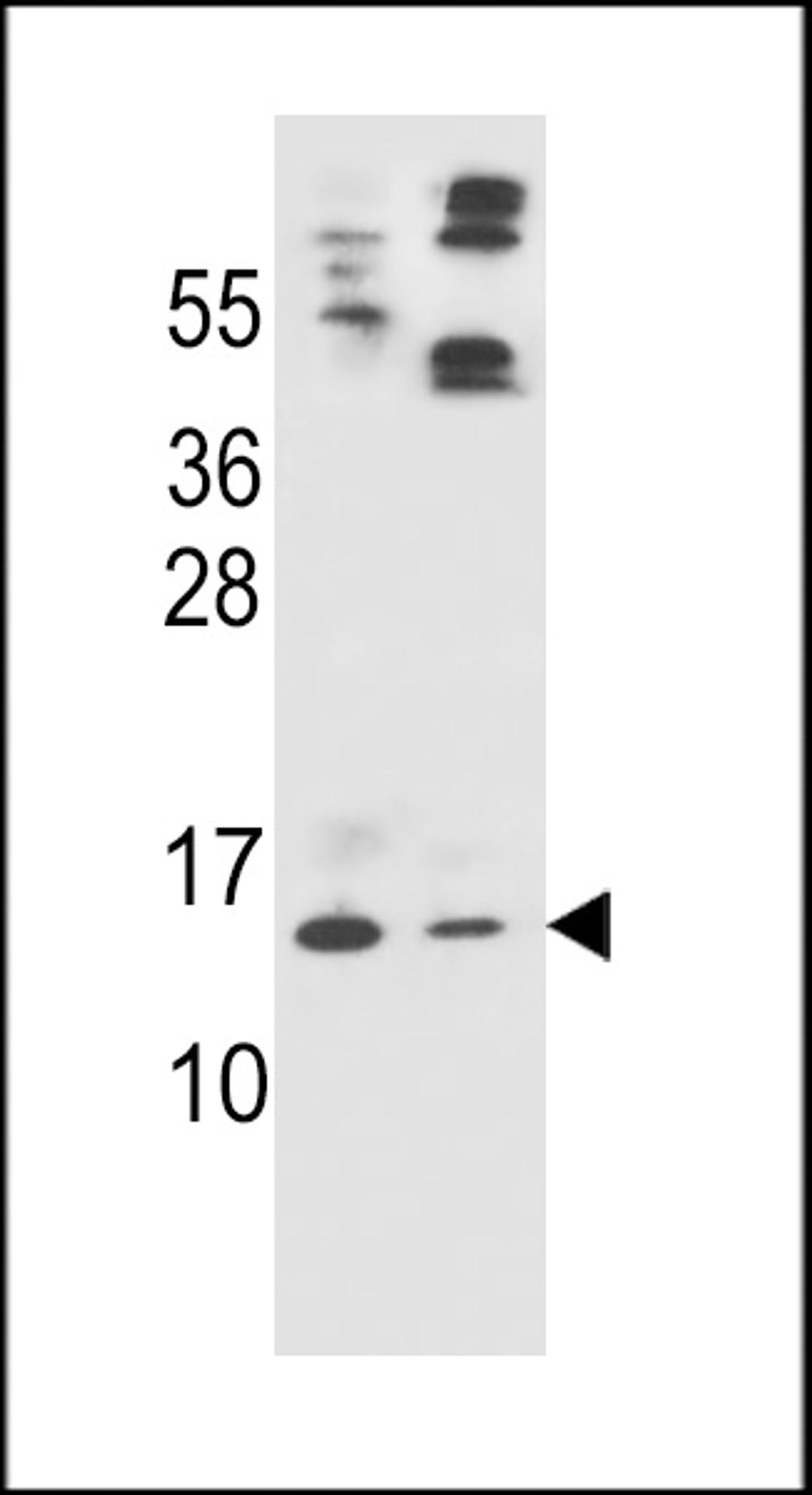 Western blot analysis in HL-60(lane 1),A549(lane 2) cell line lysates (35ug/lane).