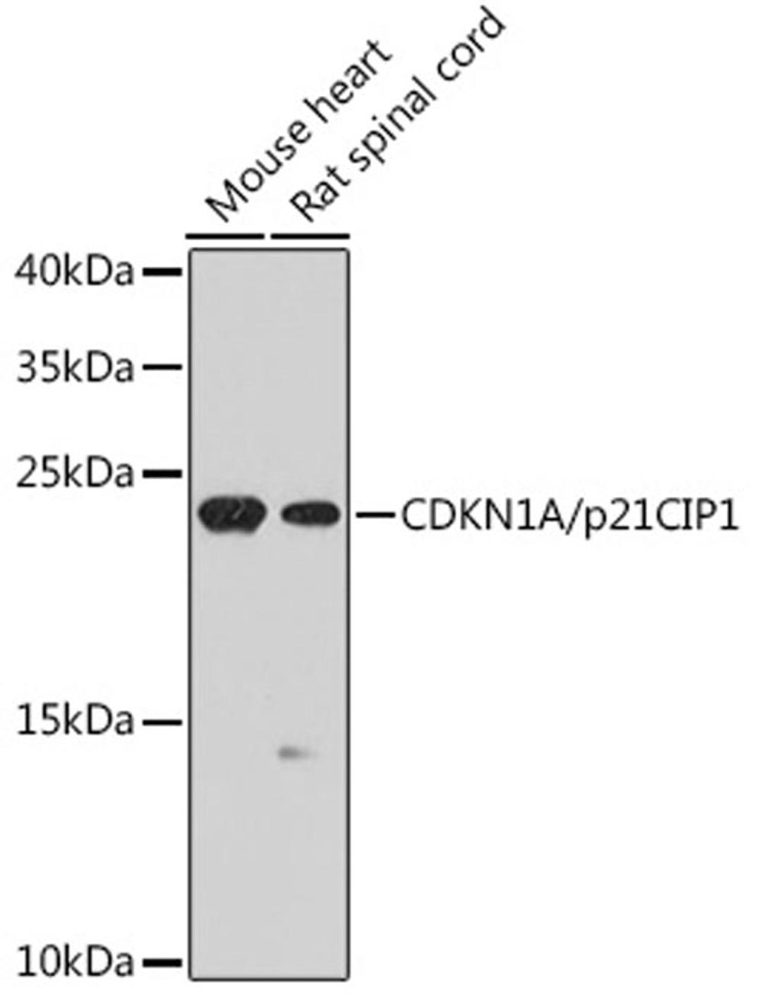 Western blot - CDKN1A/p21CIP1 antibody (A1483)