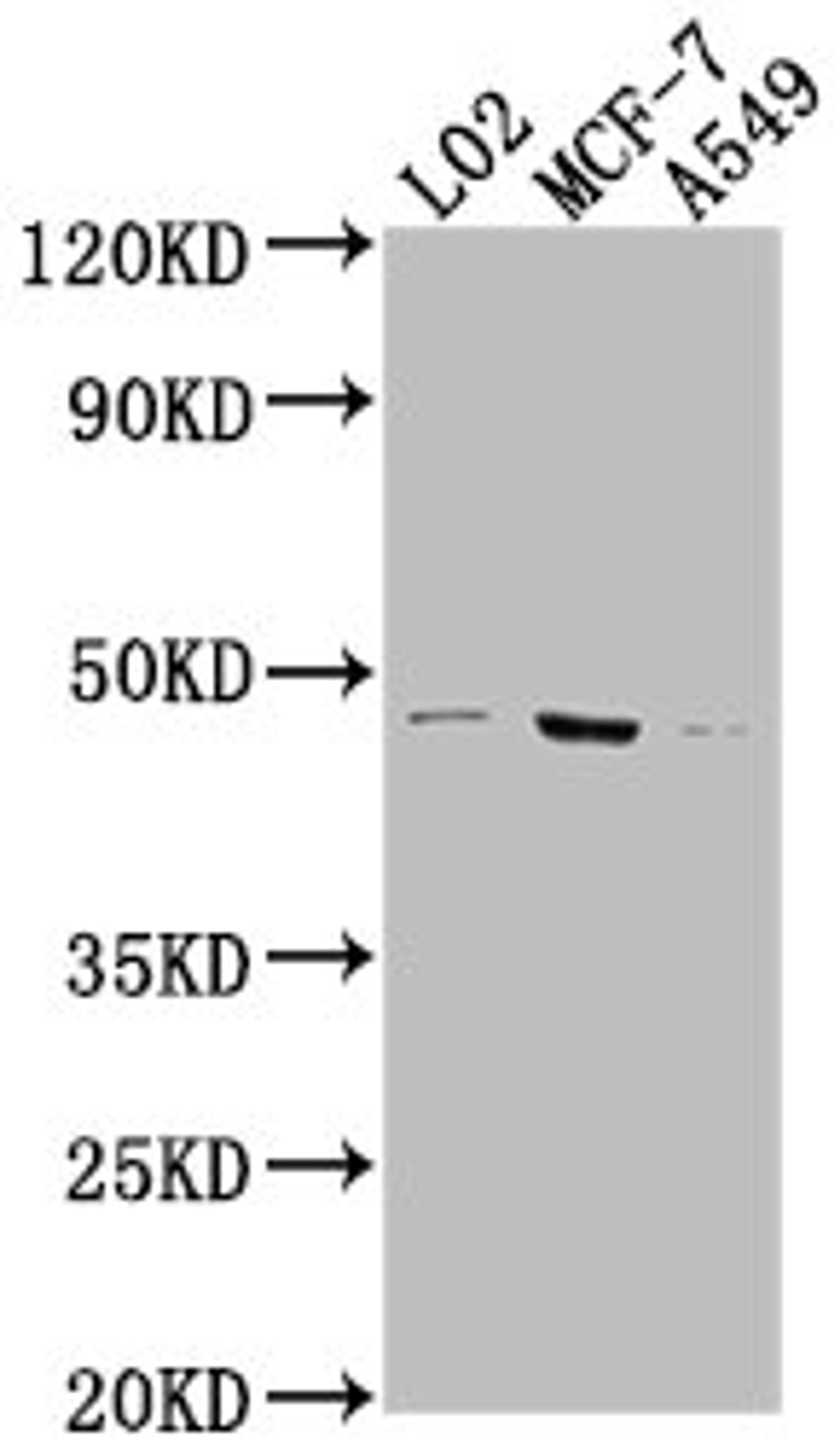 Western Blot. Positive WB detected in: LO2 whole cell lysate, MCF-7 whole cell lysate, A549 whole cell lysate. All lanes: USP17L6P antibody at 1:2000. Secondary. Goat polyclonal to rabbit IgG at 1/50000 dilution. Predicted band size: 45 kDa. Observed band size: 45 kDa. 