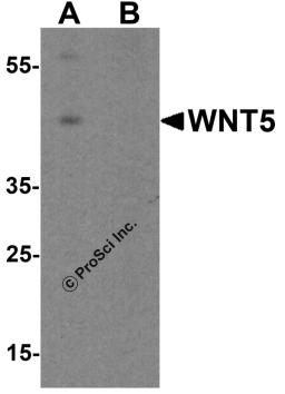 Western blot analysis of WNT5 in Jurkat cell lysate with WNT5 antibody at 1 μg/ml in (A) the absence and (B) the presence of blocking peptide.