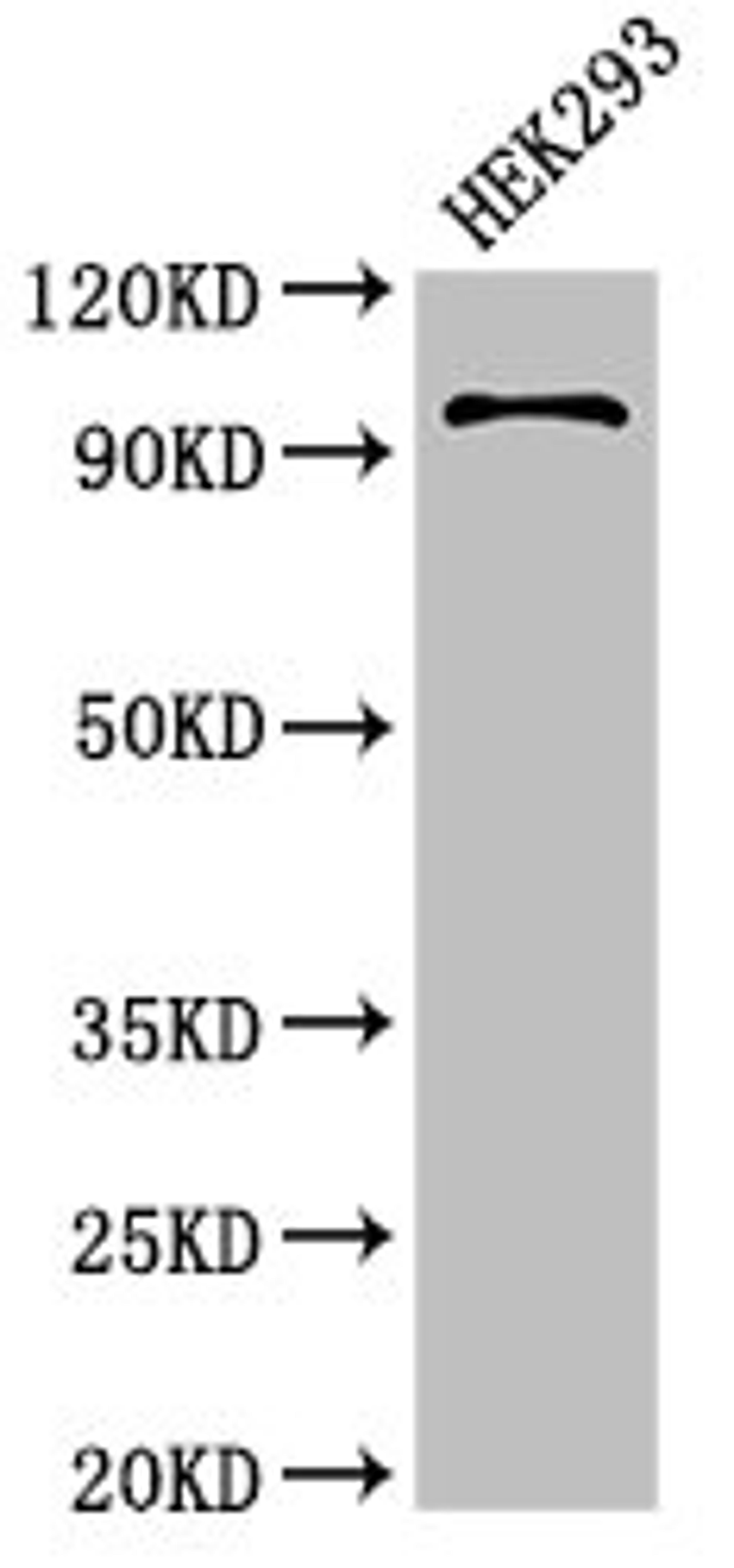 Western Blot. Positive WB detected in: HEK293 whole cell lysate. All lanes: PIWIL4 antibody at 3.4ug/ml. Secondary. Goat polyclonal to rabbit IgG at 1/50000 dilution. Predicted band size: 97, 57, 53 kDa. Observed band size: 97 kDa.